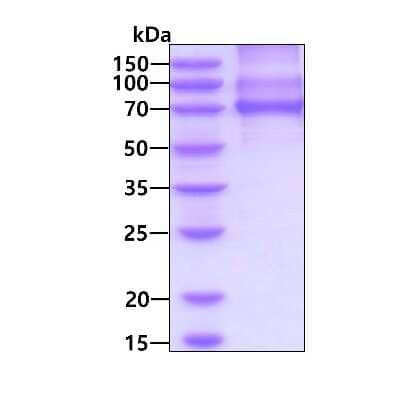 SDS-Page: Recombinant Human PKC iota His Protein [NBP3-18181] - 3ug by SDS-PAGE under reducing condition and visualized by coomassie blue stain